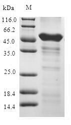 Human ABHD5 protein