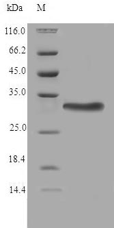 Human TMX2 protein