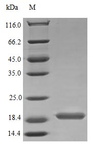 Human IL17B protein (Active)