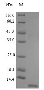Human SDF1 protein (Active)