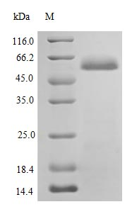 Recombinant Human Protein disulfide-isomerase protein (P4HB), partial (Active)
