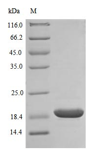 Human SODC protein (Active)