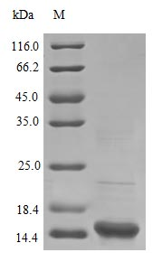 Human SODC protein (Active)