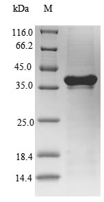 Mouse Il7r protein