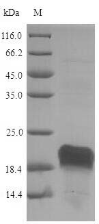 Pig HSP90AA1 protein