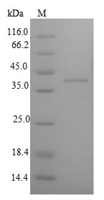 Rat IGFBP1 protein