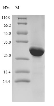 Human LPPR2 protein