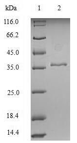 Human KRT18 protein