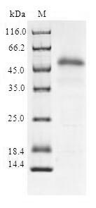 Human SOCS2 protein