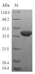 Human TIAF1 protein