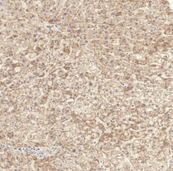 TGFBR1 Antibody
