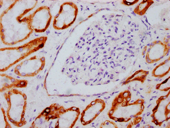 GSK3B Antibody