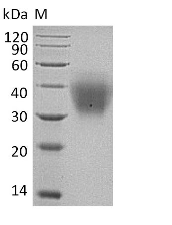 Human KITLG protein