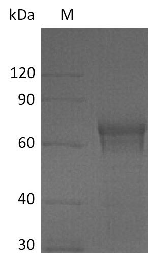 Human IL15RA protein