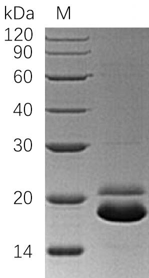 Human TNFRSF10B protein