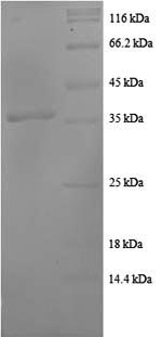 Human CCL20 protein
