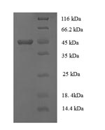Human COL18A1 protein