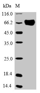 Human OPTN protein
