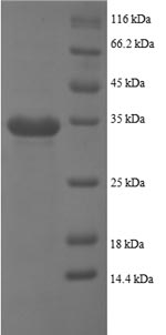 Human PPBP protein