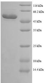 Human HADHB protein