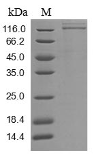 Human FLT1 protein