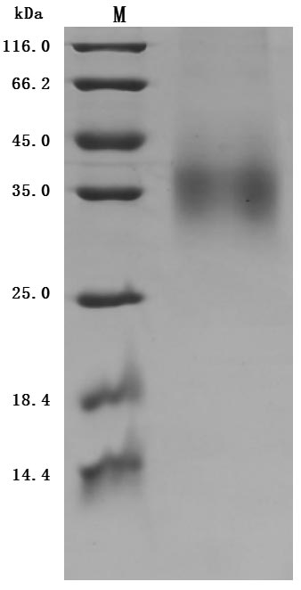 Human GCGR protein