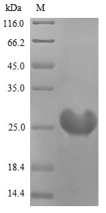 Human OSM protein