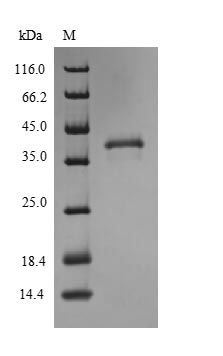 Human SLC31A1 protein