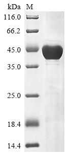 Human KRT18 protein