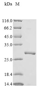 Human VDAC1 protein