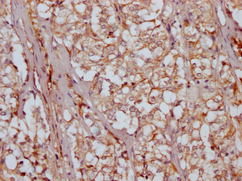 RARS2 Antibody