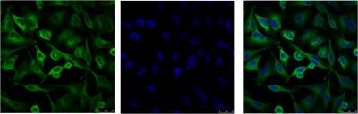 TUBA1B Antibody