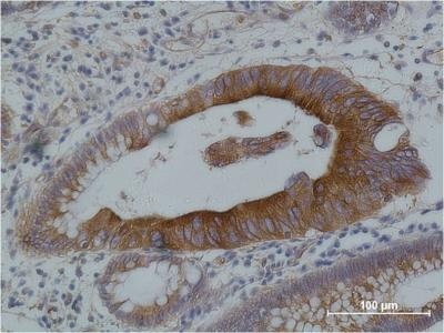 TUBA1B Antibody