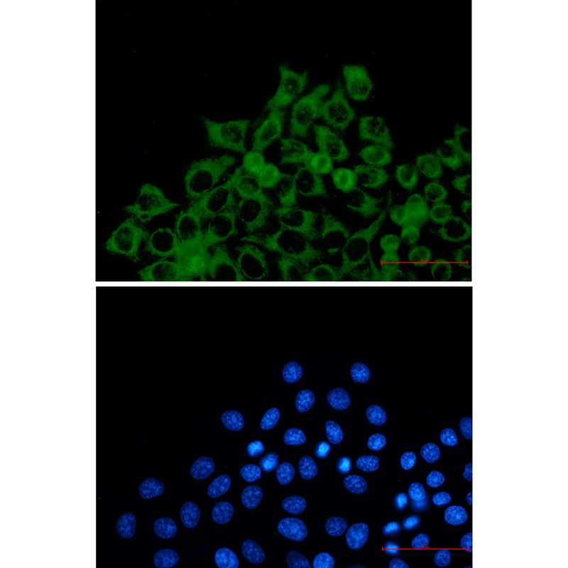 TOMM20 Antibody