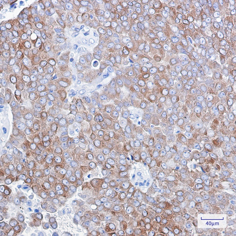BCL2 Antibody
