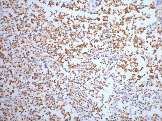ENO2 Antibody