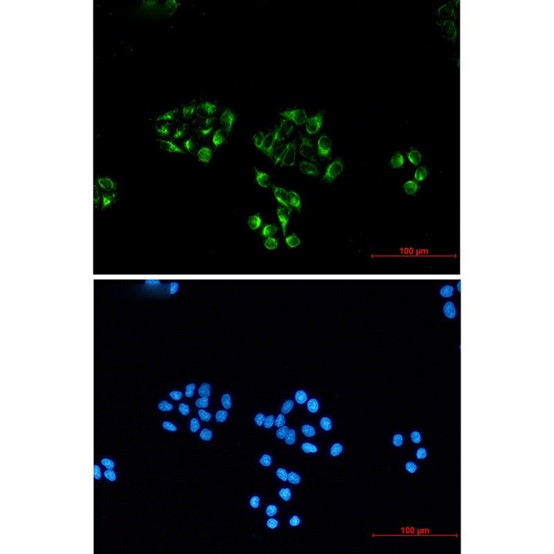 ENO2 Antibody