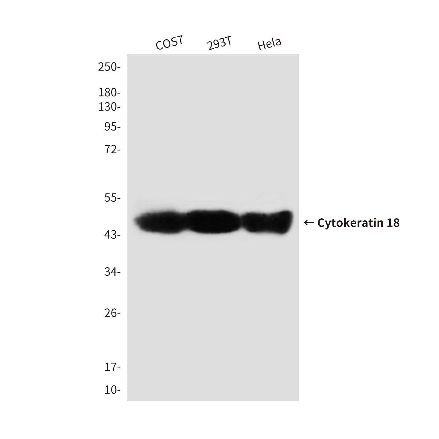 KRT18 Antibody