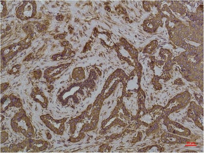 GRP78 BiP Mouse Monoclonal Antibody