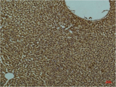 PI3 Kinase p85 alpha Mouse Monoclonal Antibody