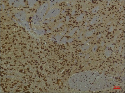 PI3 Kinase p85 alpha Mouse Monoclonal Antibody