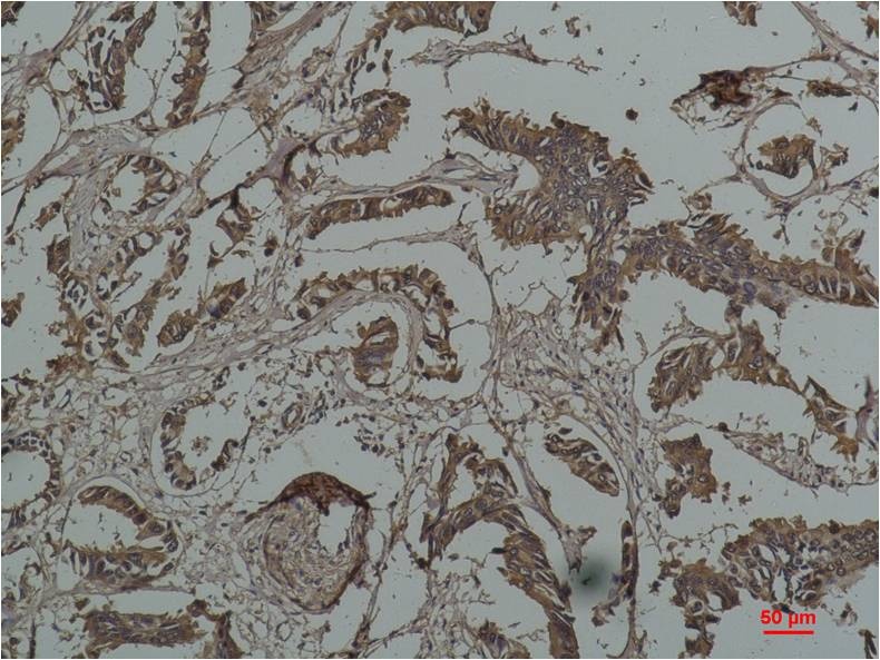 HSPB1 Antibody