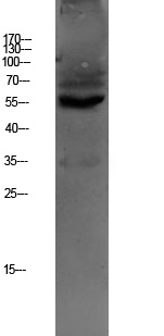 SLC22A6 Antibody