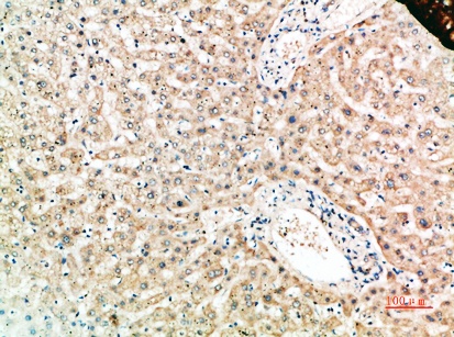 RANK Rabbit Polyclonal Antibody