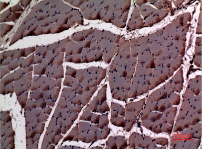 ACTC1 Antibody