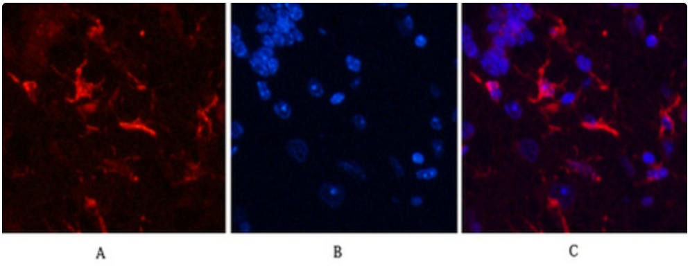 GFAP Antibody