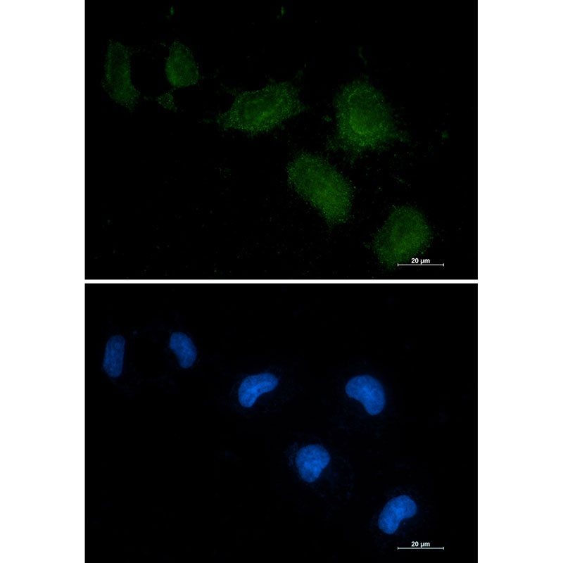 GC Antibody
