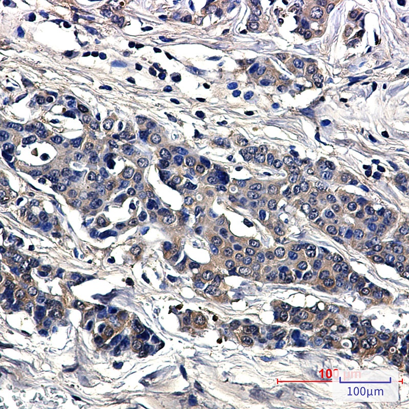 Superoxide Dismutase 1 Rabbit Monoclonal Antibody