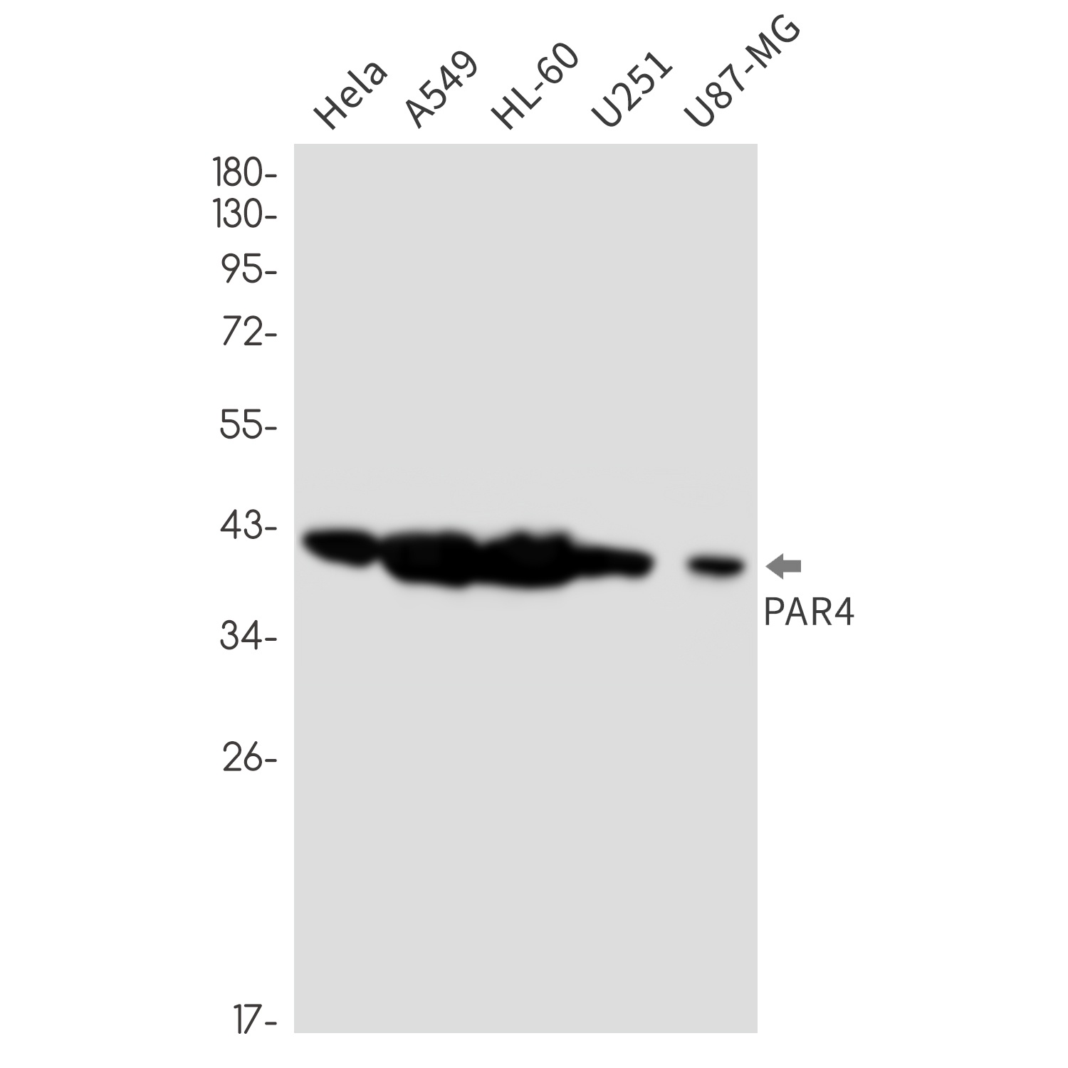 PAWR Antibody
