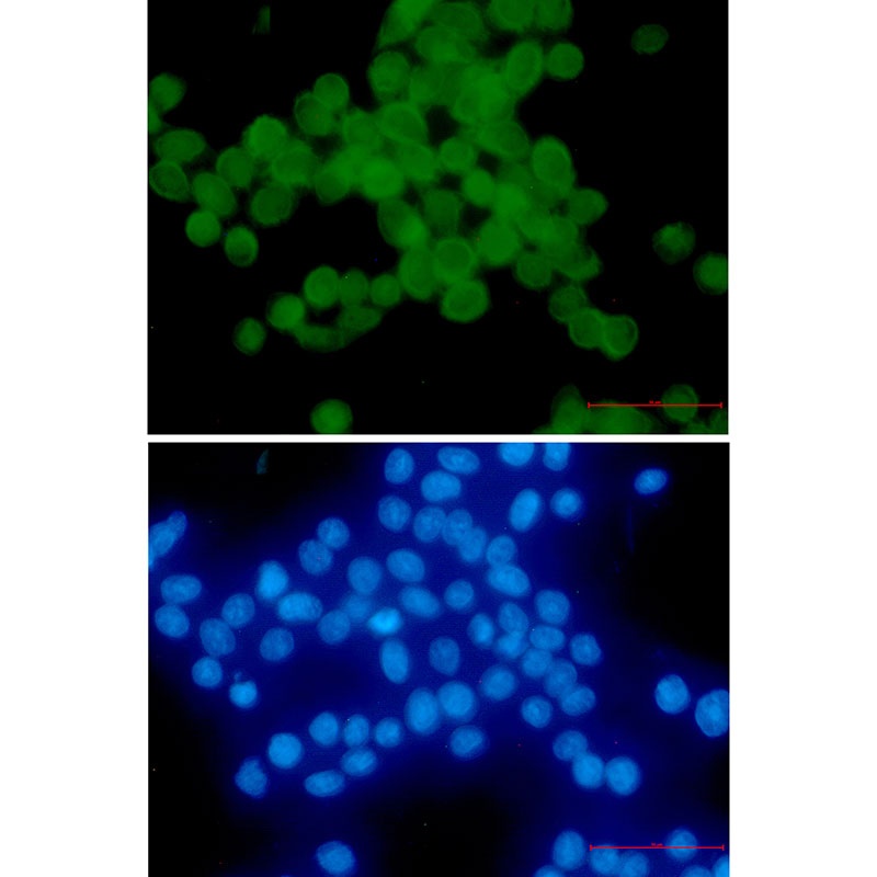 CTNND1 Antibody